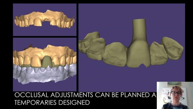 Successful Implant Referral смотреть онлайн