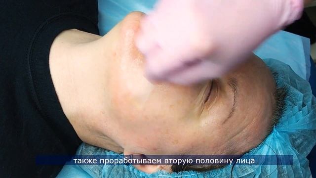 Краткий гайд по проведению процедуры пилинга усиленного бустером с ретинолом смотреть онлайн