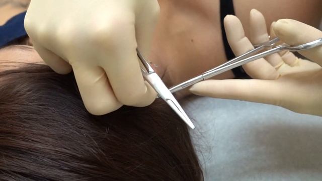 Double Helix Piercing with Seamless Hoops done at Tommy T's Body Piercing in Huntington Beach, CA смотреть онлайн