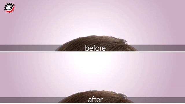 देखिए PLASTIC SURGERY कैसे होता है? Face Changing Plastic Surgery |Face Transformation Surgery. смотреть онлайн