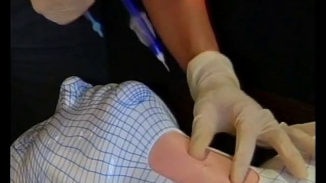 Smiths-Portex-Cricothyreotomia-Rus