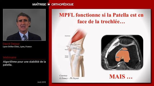 Dr Dejour présente l'algorithme de la stabilisation de la rotule смотреть онлайн