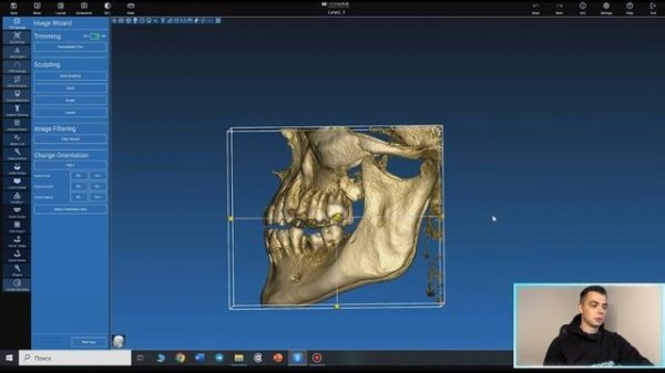 Обучение хирургическим шаблонам в программе RealGuide. Начало работы, настройка файлов.