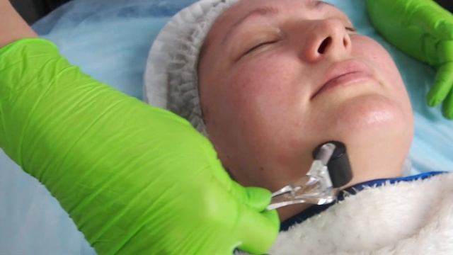 Гайд по процедуре с пилингом мансол (Manssol) смотреть онлайн