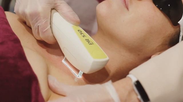 Candela IGTV Nordlys IPL pigmentation body tag @gemkwatts @glow journal смотреть онлайн