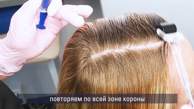 Процедура восстановления роста волос смотреть онлайн