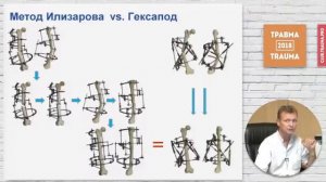 Основы биомеханики черескостного остеосинтеза (2)