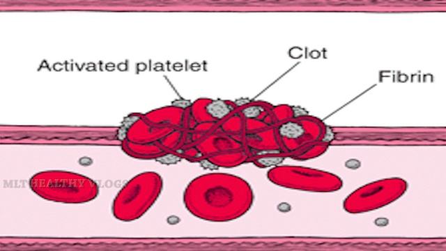 Platelets | Bscmlt | Dmlt | MLT Healthy Vlogs | in Telugu смотреть онлайн