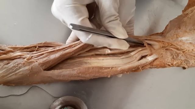 Flexor / anterior compartment muscles, nerves and blood vessels of forearm смотреть онлайн
