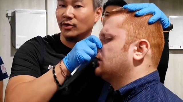 Chris Leong | Broken Nose😱😰