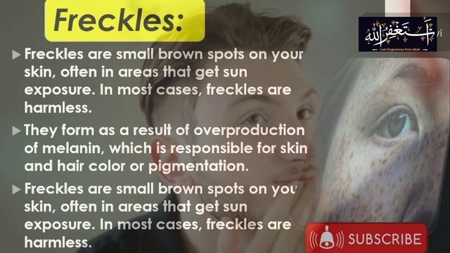 Freckles Treatment | Freckles Cream | Freckles Symptoms, Freckles Causes, смотреть онлайн