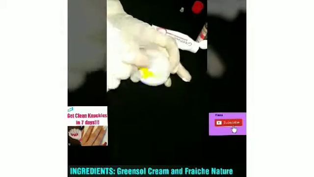 Dark Knuckles and Dark Area Cream #KnucklesCream #DarkElbowsCream смотреть онлайн