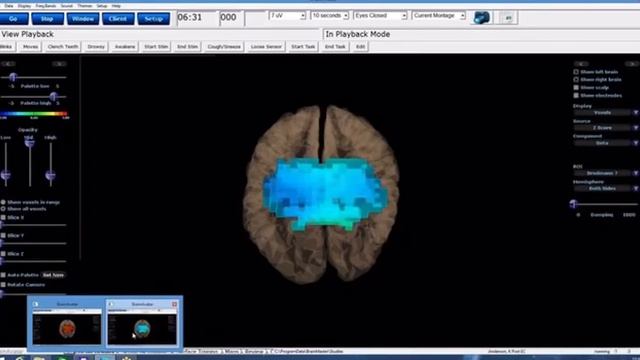 Научные исследования Access bars. Эффективность метода доказана. #accessbars смотреть онлайн
