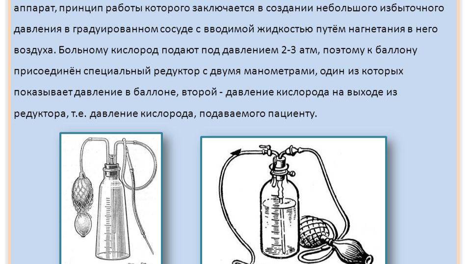Аппарат Боброва смотреть онлайн