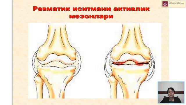 Revmatik isitma смотреть онлайн