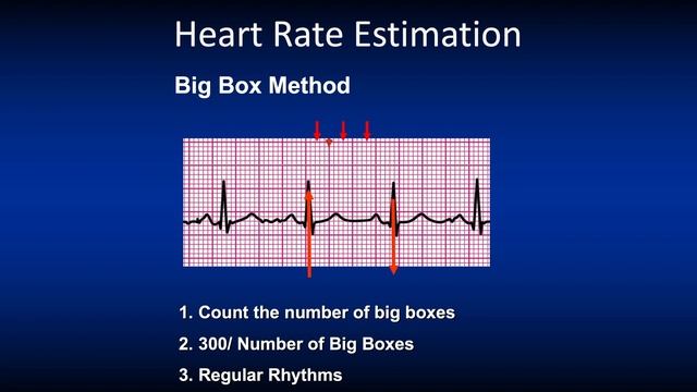 Basic ECG/ EKG Part 2: The Anatomy of the ECG/ EKG & 5-Step Method смотреть онлайн