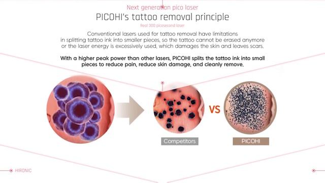 [PICOHI] The Most Advanced 300 ps Laser Technology l Lentigine l Tattoo Removal l Scratched Scar смотреть онлайн