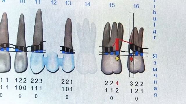 Florida Probe - компьютерная система диагностики пародонтита | Florida Probe Corporation (США)