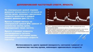 Выпуск 21.  Допплеровский частотный спектр, спектральная кривая