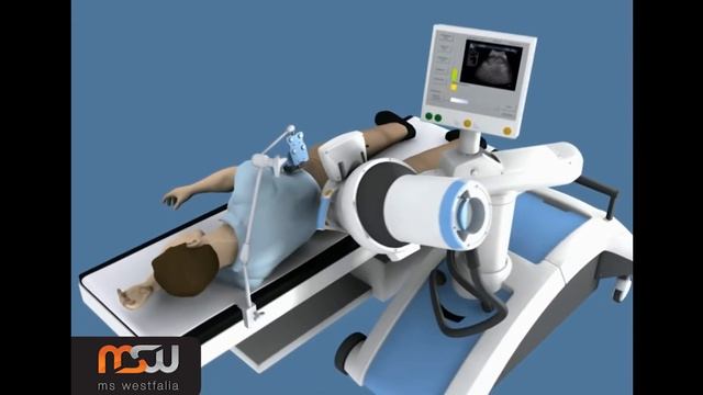 Lithotripter For Urology And Orthopedics Polaris (MS Westfalia GmbH)