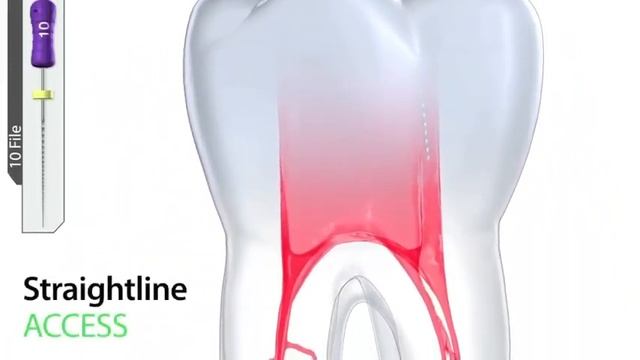 ProGlider™ Rotary Glide Path File – Product Overview | Dentsply Sirona смотреть онлайн