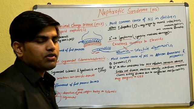 Nephrotic syndrome part 2/4 смотреть онлайн