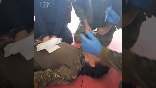 Як правильно вводити назофарингеальну трубку смотреть онлайн