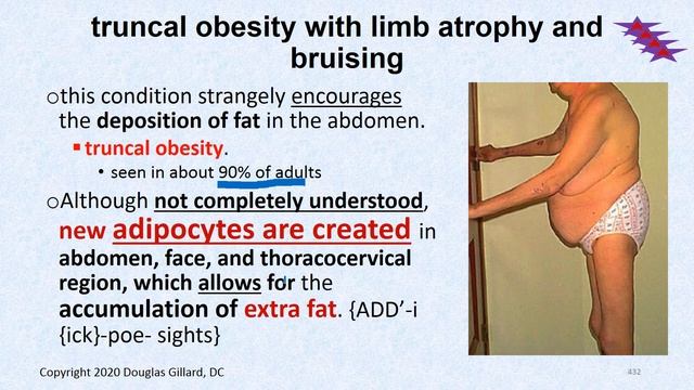 Endocrinology: (WK7)(Mon)(Spr20): Cushing's disease & Part II of Cushing's Syndrome. смотреть онлайн