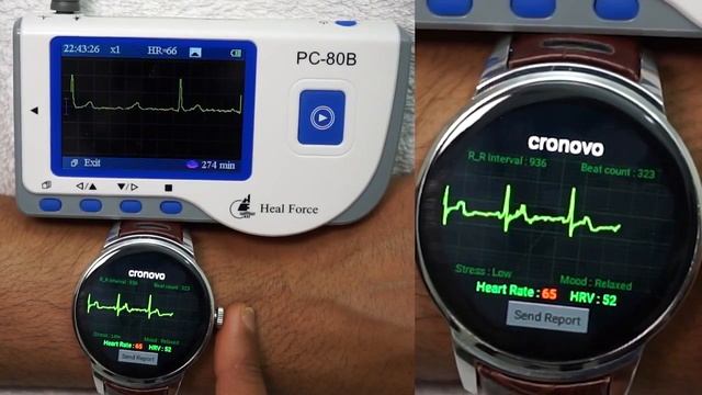 ECG EKG Cronovo Smart Watch compared with FDA Device смотреть онлайн