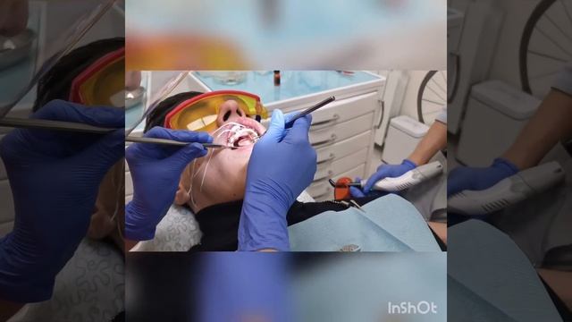 Фиксация ретейнера в стоматологии Химки смотреть онлайн