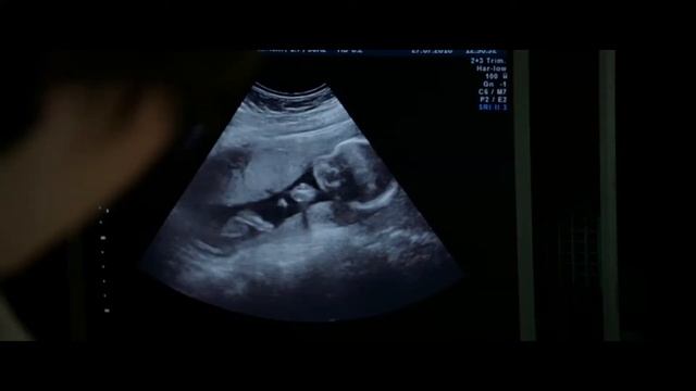 Tráiler De 'Ana, Mon Amour'