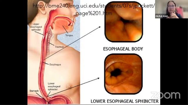 Problem Solving Your Gut: the Mental, Emotional and Physical смотреть онлайн