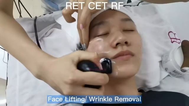 448khz Indiba Deep Body Care Tecartherapy RET CET RF Machine