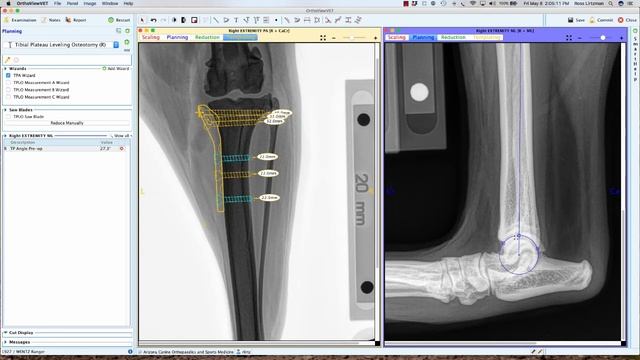 TPLO Planning Using OrthoView Vet Two Dimensional Orthopedic Planning Software