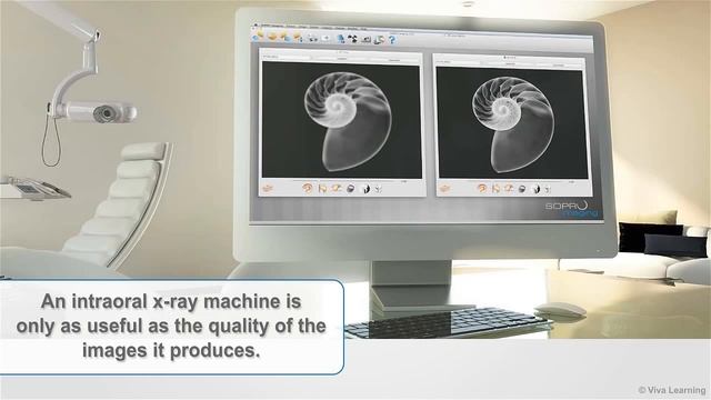 De Gotzen x - ray x mind unity overview смотреть онлайн