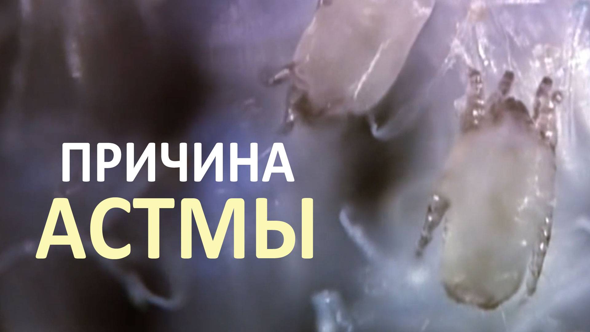 Почему пылевые клещи - самые коварные вредители, которые наверняка живут рядом с вами?