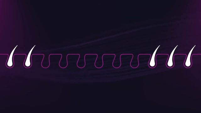 GentleMax Pro Plus Launch Video смотреть онлайн