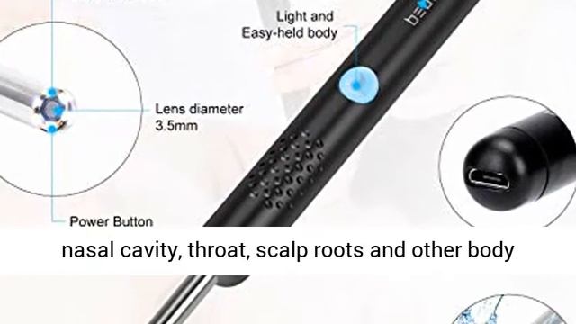 Ear Wax Removal, Enjoyee Ear Cleaner Ear Wax Removal Kit, Wireless Ear Wax Remover Otoscope with 10 смотреть онлайн