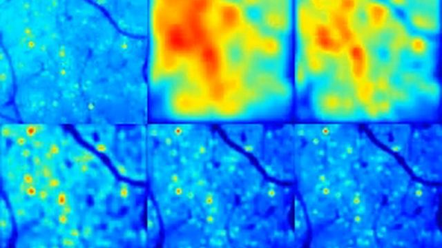 Noise removal two-photon Ca2+ imaging by 3D feature interpolation Unet model смотреть онлайн