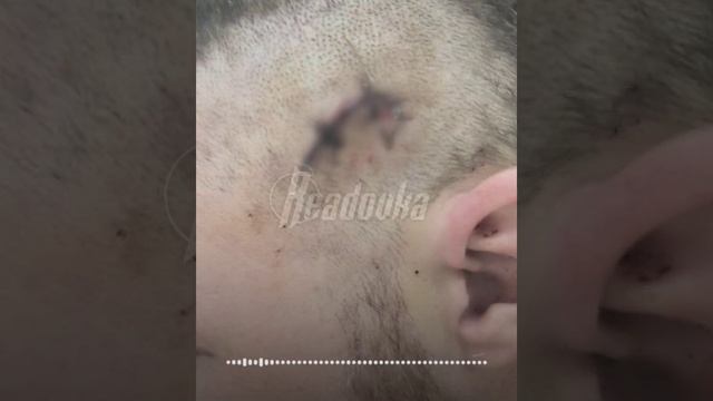 Бывший девушки участника СВО вместе с друзьями вломился в квартиру и проломил ему голову молотком смотреть онлайн