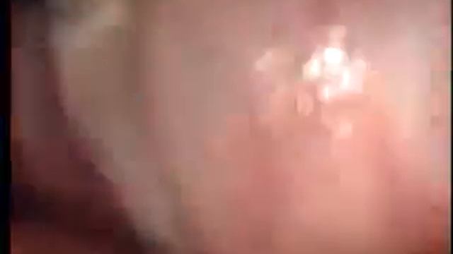 Port site Bleeding смотреть онлайн