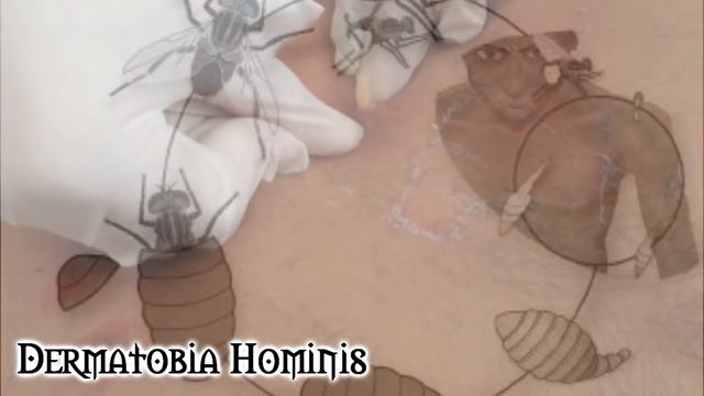 Top 5 SERES Horrendos Encontrados DENTRO de HUMANOS || RPNety смотреть онлайн