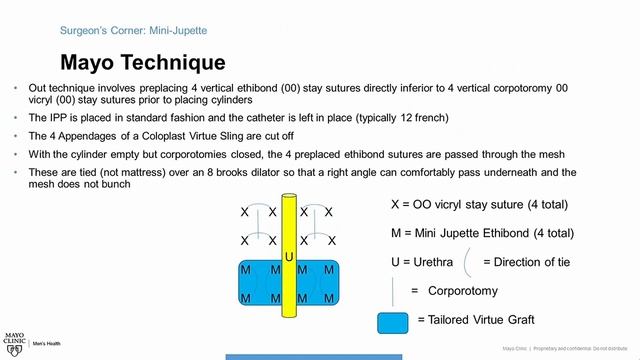 Mayo Clinic Men's Health Moment: IPP Surgeons Corner - Mini-Jupette for Stress Incontinence смотреть онлайн