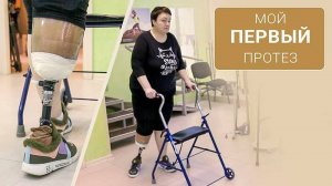 Первый протез голени, чтобы работать дальше