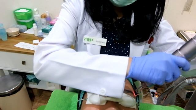 REVIEW ZAP PHOTO LASER смотреть онлайн