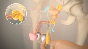Анимация работы искусственного сфинктера AMS 800