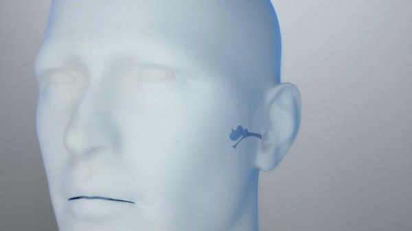 Product Video EXTARO 300