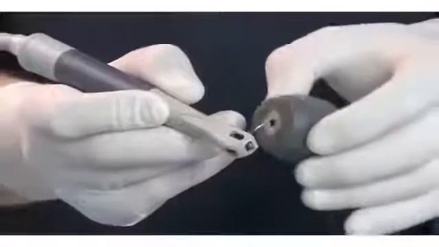 Vector PARO. Парадонтологический аппарат Обзор смотреть онлайн