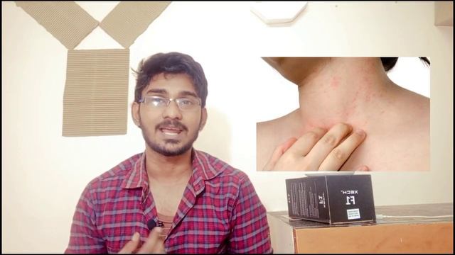 Mederma cream vs gel | Mederma cream in tamil |Mederma advanced gel in tamil | yogesh meditech смотреть онлайн