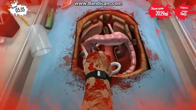 Как мы с другом играем в Surgeon  Simulator, Часть  2, НАКОНЕЦТО ВЫРЕЗАЛИ